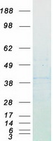 CCND1 / Cyclin D1 Protein - Purified recombinant protein CCND1 was analyzed by SDS-PAGE gel and Coomassie Blue Staining