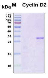 CCND2 / Cyclin D2 Protein - SDS-PAGE under reducing conditions and visualized by Coomassie blue staining