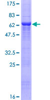 CCND2 / Cyclin D2 Protein - 12.5% SDS-PAGE of human CCND2 stained with Coomassie Blue