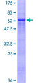 CCND2 / Cyclin D2 Protein - 12.5% SDS-PAGE of human CCND2 stained with Coomassie Blue