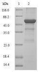CCND2 / Cyclin D2 Protein - (Tris-Glycine gel) Discontinuous SDS-PAGE (reduced) with 5% enrichment gel and 15% separation gel.