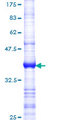 CCND3 / Cyclin D3 Protein - 12.5% SDS-PAGE Stained with Coomassie Blue.