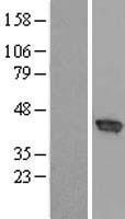 CCNDBP1 / GCIP Protein - Western validation with an anti-DDK antibody * L: Control HEK293 lysate R: Over-expression lysate