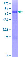CCNDBP1 / GCIP Protein - 12.5% SDS-PAGE of human CCNDBP1 stained with Coomassie Blue