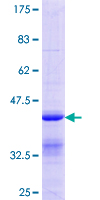 CCNDBP1 / GCIP Protein - 12.5% SDS-PAGE Stained with Coomassie Blue.