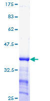 CCNE1 / Cyclin E1 Protein - 12.5% SDS-PAGE Stained with Coomassie Blue.