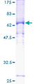 CCNE2 / Cyclin E2 Protein - 12.5% SDS-PAGE of human CCNE2 stained with Coomassie Blue