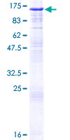 CCNF / Cyclin F Protein - 12.5% SDS-PAGE of human CCNF stained with Coomassie Blue