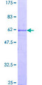 CCNG1 / Cyclin G1 Protein - 12.5% SDS-PAGE of human CCNG1 stained with Coomassie Blue
