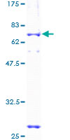 CCNG2 / Cyclin G2 Protein - 12.5% SDS-PAGE of human CCNG2 stained with Coomassie Blue