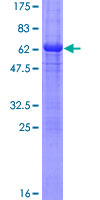 CCNH / Cyclin H Protein - 12.5% SDS-PAGE of human CCNH stained with Coomassie Blue