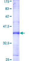 CCNH / Cyclin H Protein - 12.5% SDS-PAGE Stained with Coomassie Blue.