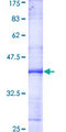 CCNH / Cyclin H Protein - 12.5% SDS-PAGE Stained with Coomassie Blue.