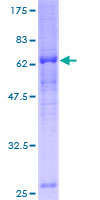 CCNJ Protein - 12.5% SDS-PAGE of human CCNJ stained with Coomassie Blue