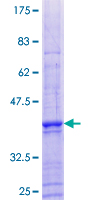 CCNJL Protein - 12.5% SDS-PAGE of human FLJ14166 stained with Coomassie Blue