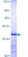 CCNT1 / Cyclin T1 Protein - 12.5% SDS-PAGE Stained with Coomassie Blue.