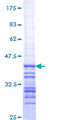 CCNT2 / Cyclin T2 Protein - 12.5% SDS-PAGE Stained with Coomassie Blue.