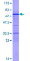 CCNY / Cyclin Y Protein - 12.5% SDS-PAGE of human C10orf9 stained with Coomassie Blue
