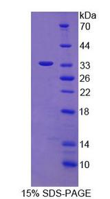CCP110 Protein - Recombinant Centrosomal Protein 110kDa By SDS-PAGE