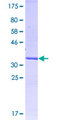 CCR1 Protein - 12.5% SDS-PAGE Stained with Coomassie Blue.