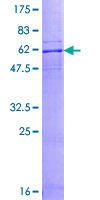 CCR10 / GPR2 Protein - 12.5% SDS-PAGE of human CCR10 stained with Coomassie Blue