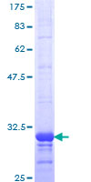 CCR2 Protein - 12.5% SDS-PAGE Stained with Coomassie Blue.