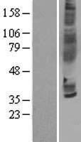 CCR3 Protein - Western validation with an anti-DDK antibody * L: Control HEK293 lysate R: Over-expression lysate