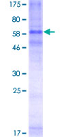 CCR3 Protein - 12.5% SDS-PAGE of human CCR3 stained with Coomassie Blue