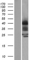 CCR4 Protein - Western validation with an anti-DDK antibody * L: Control HEK293 lysate R: Over-expression lysate