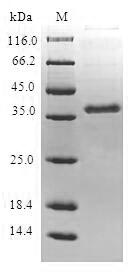CCR4 Protein - (Tris-Glycine gel) Discontinuous SDS-PAGE (reduced) with 5% enrichment gel and 15% separation gel.