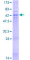 CCR5 Protein - 12.5% SDS-PAGE of human CCR5 stained with Coomassie Blue