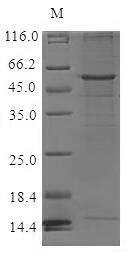 CCR6 Protein - (Tris-Glycine gel) Discontinuous SDS-PAGE (reduced) with 5% enrichment gel and 15% separation gel.
