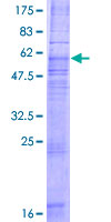 CCR8 / CD198 Protein - 12.5% SDS-PAGE of human CCR8 stained with Coomassie Blue