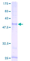 CCRL2 Protein - 12.5% SDS-PAGE of human CCRL2 stained with Coomassie Blue