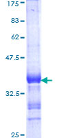 CCRN4L / Nocturnin Protein - 12.5% SDS-PAGE Stained with Coomassie Blue.