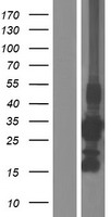 CCS Protein - Western validation with an anti-DDK antibody * L: Control HEK293 lysate R: Over-expression lysate