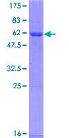 CCS Protein - 12.5% SDS-PAGE of human CCS stained with Coomassie Blue