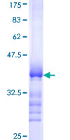 CCS Protein - 12.5% SDS-PAGE Stained with Coomassie Blue.