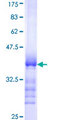 CCS Protein - 12.5% SDS-PAGE Stained with Coomassie Blue.