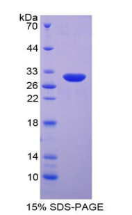 CCS Protein - Recombinant Superoxide Dismutase, Copper Chaperone By SDS-PAGE