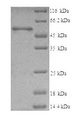 CCT2 / CCT Beta Protein - (Tris-Glycine gel) Discontinuous SDS-PAGE (reduced) with 5% enrichment gel and 15% separation gel.