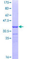 CCT2 / CCT Beta Protein - 12.5% SDS-PAGE Stained with Coomassie Blue.