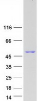 CCT2 / CCT Beta Protein - Purified recombinant protein CCT2 was analyzed by SDS-PAGE gel and Coomassie Blue Staining