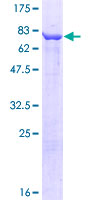 CCT3 Protein - 12.5% SDS-PAGE of human CCT3 stained with Coomassie Blue