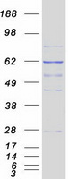 CCT3 Protein - Purified recombinant protein CCT3 was analyzed by SDS-PAGE gel and Coomassie Blue Staining