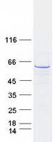 CCT3 Protein - Purified recombinant protein CCT3 was analyzed by SDS-PAGE gel and Coomassie Blue Staining