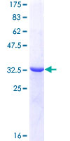 CCT4 / SRB Protein - 12.5% SDS-PAGE Stained with Coomassie Blue.