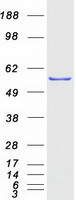 CCT4 / SRB Protein - Purified recombinant protein CCT4 was analyzed by SDS-PAGE gel and Coomassie Blue Staining