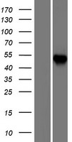 CCT6A Protein - Western validation with an anti-DDK antibody * L: Control HEK293 lysate R: Over-expression lysate