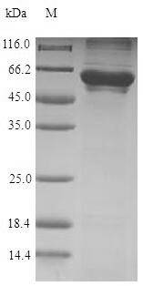 CCT6A Protein - (Tris-Glycine gel) Discontinuous SDS-PAGE (reduced) with 5% enrichment gel and 15% separation gel.